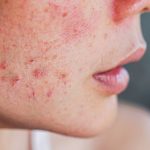 Cosa fa il testosterone al corpo femminile?